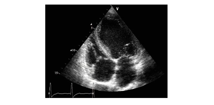 échograpphie cardiaque télémédecine alsace formation